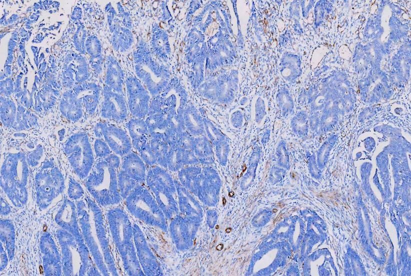 Antigen Retrieval 06